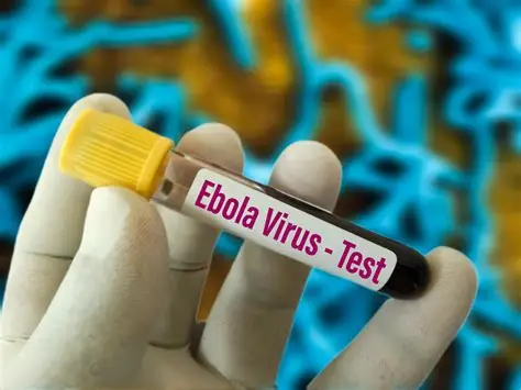 Ebola : Comprendre la maladie pour mieux la prévenir